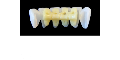 Ref.E10+E10 f Lower Anterior :  1x  white wax veneer-bridge, (33-43), carved to fit over its compatible yellow hollow pontic block-frame, (32-42) , both MEDIUM, for porcelain pressed to metal bridgework