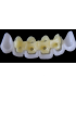 Ref.E1+E1 f Upper Anterior :  1x  white wax veneer-bridge, (23-13), carved to fit over its compatible yellow hollow pontic block-frame, (22-12) , both LARGE, Tapering ovoid,  for porcelain pressed to metal bridgework