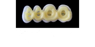 Ref.E1+E1 f Upper Right :  1x  white wax veneer-bridge, carved to fit over its compatible yellow hollow pontic block-frame, both  LARGE, (44-47), for porcelain pressed to metal bridgework