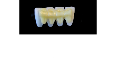 Ref.E23+E23 f Lower Anterior :  1x  white wax veneer-bridge, (32-42), carved to fit over its compatible yellow hollow pontic block-frame, (32-42) , both MEDIUM, for porcelain pressed to metal bridgework