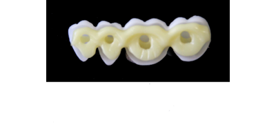 Ref.E4+E4 f Lower Right :  1x  white wax veneer-bridge, carved to fit over its compatible yellow hollow pontic block-frame, both  MEDIUM, (44-47), for porcelain pressed to metal bridgework