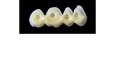 Ref.E4+E4 f Upper Left :  1x  white wax veneer-bridge, carved to fit over its compatible yellow hollow pontic block-frame, both  MEDIUM, (27-24), for porcelain pressed to metal bridgework