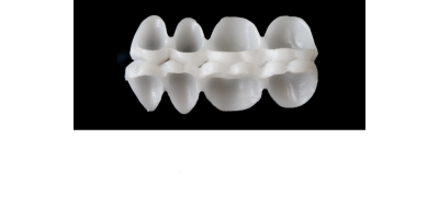 Ref.E4UPPER+LOWER RIGHT : 1x  pair of posterior hollow wax veneer-bridges, MEDIUM, (17-14)+(47-44), with precarved gnathological occlusion.