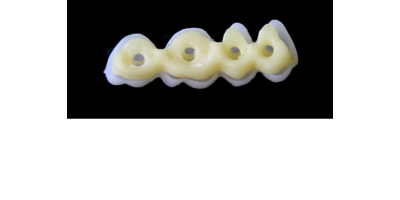 Ref.E5+E5 f Upper Left :  1x  white wax veneer-bridge, carved to fit over its compatible yellow hollow pontic block-frame, both  SMALL, (27-24), for porcelain pressed to metal bridgework