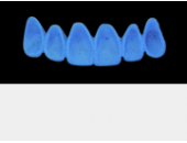 Cod.A1Lingual : 10x  wax lingual bridges,  LARGE, Tapering ovoid, TOOTH 13-23, compatible with Cod.C1Facing,TOOTH 13-23 for long-term provisionals preparation