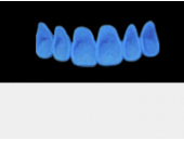 Cod.A2Lingual : 10x  wax lingual bridges,  LARGE-Wide, Tapering ovoid,  (13-23), compatible with Cod.C2Facing,TOOTH 13-23 for long-term provisionals preparation