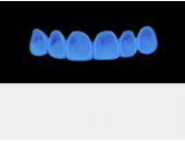Cod.A3Lingual : 10x  wax lingual bridges,  MEDIUM, Square tapering, TOOTH 13-23, compatible with Cod.C3Facing,TOOTH 13-23, for long-term provisionals preparation