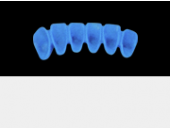 Cod.A10Lingual : 10x  wax lingual bridges,  Medium, Aligned, TOOTH 43-33, compatible with Cod.C10Facing,TOOTH  43-33 for long-term provisionals preparation