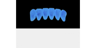Cod.A12Lingual : 10x  wax lingual bridges,  SMALL, Aligned, TOOTH 43-33, compatible with Cod.C12Facing,TOOTH  43-33 for long-term provisionals preparation