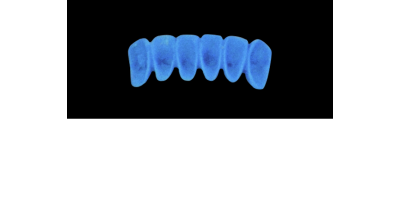 Cod.A15Lingual : 10x  wax lingual bridges,  SMALL, Overlapping, TOOTH 43-33, compatible with Cod.C15Facing,TOOTH  43-33 for long-term provisionals preparation