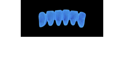 Cod.A16Lingual : 10x  wax lingual bridges,  Medium, Overlapping, TOOTH 43-33, compatible with Cod.C16Facing,TOOTH  43-33 for long-term provisionals preparation