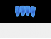 Cod.A23Lingual : 15x  wax lingual bridges,  Medium, Aligned, TOOTH 42-32, compatible with Cod.C23Facing,TOOTH  42-32 for long-term provisionals preparation
