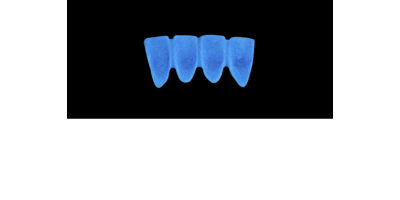Cod.A24Lingual : 15x  wax lingual bridges,  SMALL, Overlapping, TOOTH 42-32, compatible with Cod.C24Facing,TOOTH  42-32 for long-term provisionals preparation