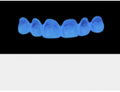 Cod.A7Lingual : 10x  wax lingual bridges,  SMALL, Square ovoid, TOOTH 13-23, compatible with Cod.C7Facing,TOOTH 13-23, for long-term provisionals preparation