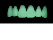 Cod.C2Facing : 10x  wax facings-bridges,  LARGE-Wide, Tapering ovoid, broad cervix, TOOTH 13-23, compatible with Cod.A2Lingual,TOOTH 13-23 for long-term provisionals preparation