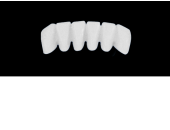 Cod.E11LOWER ANTERIOR: 10x  wax facings-bridges (hollow), MEDIUM, Overlapping, (43-33), compatible with solid (not  hollow) wax bridges Cod.S11LOWER ANTERIOR, (43-33)