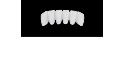 Cod.E11LOWER ANTERIOR: 10x  wax facings-bridges (hollow), MEDIUM, Overlapping, (43-33), compatible with solid (not  hollow) wax bridges Cod.S11LOWER ANTERIOR, (43-33)