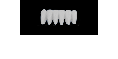 Cod.E13LOWER ANTERIOR: 10x  wax facings-bridges (hollow), MEDIUM, Long, Aligned, (43-33), compatible with solid (not  hollow) wax bridges Cod.S13LOWER ANTERIOR, (43-33)