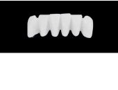 Cod.S16LOWER ANTERIOR : 10x  solid (not hollow) wax bridges, MEDIUM, Overlapping, (43-33), compatible to Cod.E16LOWER ANTERIOR (hollow), (43-33)