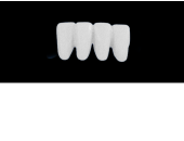 Cod.E24LOWER ANTERIOR : 10x  wax facings-bridges (hollow), MEDIUM, Overlapping, (42-32), compatible with solid (not  hollow) wax bridges Cod.S24LOWER ANTERIOR, (42-32)