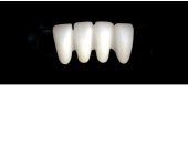 Cod.E23LOWER ANTERIOR : 15x  wax facings-bridges (hollow), MEDIUM, Aligned, (42-32), compatible with solid (not  hollow) wax bridges Cod.S23LOWER ANTERIOR, (42-32)