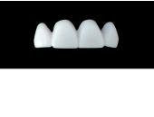 Cod.E19UPPER ANTERIOR : 15x  wax facings-bridges (hollow), MEDIUM, Square tapering, arch, (12-22), compatible with solid (not  hollow) wax bridges Cod.S19UPPER ANTERIOR, (12-22)