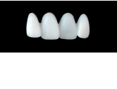 Cod.S20UPPER ANTERIOR : 15x  solid (not hollow) wax bridges, MEDIUM, Tapering ovoid, overlapping, (12-22), compatible to Cod.E20UPPER ANTERIOR (hollow), (12-22)