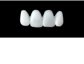 Cod.E21UPPER ANTERIOR : 15x  wax facings-bridges (hollow), SMALL, Tapering ovoid, (12-22), compatible with solid (not  hollow) wax bridges Cod.S21UPPER ANTERIOR, (12-22)
