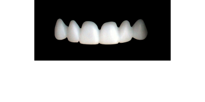 Cod.S7UPPER ANTERIOR : 10x  solid (not hollow) wax bridges, SMALL, Square ovoid, (13-23), compatible to Cod.E7UPPER ANTERIOR (hollow), (13-23)