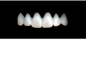 Cod.S8UPPER ANTERIOR : 10x  solid (not hollow) wax bridges, SMALL, Tapering ovoid, (13-23), compatible to Cod.E8UPPER ANTERIOR (hollow), (13-23)