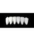 Ref.E9+E9 f Lower Anterior :  1x  white wax veneer-bridge, (33-43), carved to fit over its compatible yellow hollow pontic block-frame, (32-42) , both LARGE, for porcelain pressed to metal bridgework