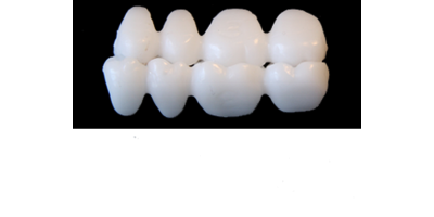 Ref.S4UPPER+LOWER RIGHT : 1x  pair of posterior solid wax bridges, MEDIUM, (17-14)+(47-44), with precarved gnathological occlusion.